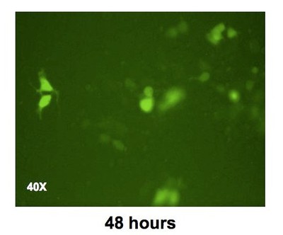 Transfected HEK 293