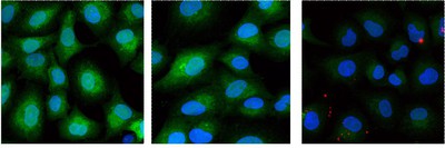 Positive Binding of EGF Targeted Protocell