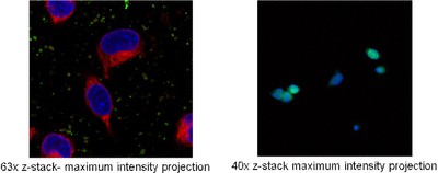 Maximum Intensity Projections