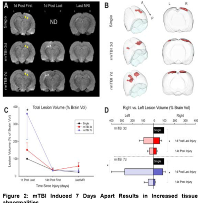 mTBI Induced 7 Days Apart Results in Increased tissue abnormalities.