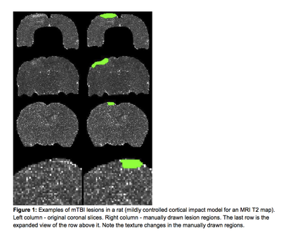 Figure 1: Examples of mTBI lesions