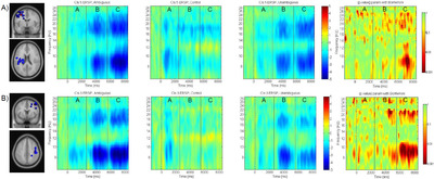 Time frequency plots and statistics for EEG data