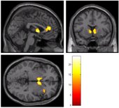 0549352_2013_sweitzer-2013-fmri