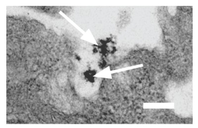 Fig. 2. Interaction of Nanoparticle with Cell Surface