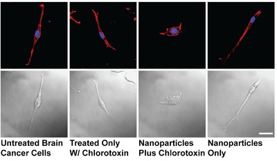 Fig. 3. Tumor Cell Shape Modification by Chlorotoxin-Nanoparticles