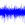 Somatotopy in the Inferior Colliculus: Implications for a New Tinnitus Treatment